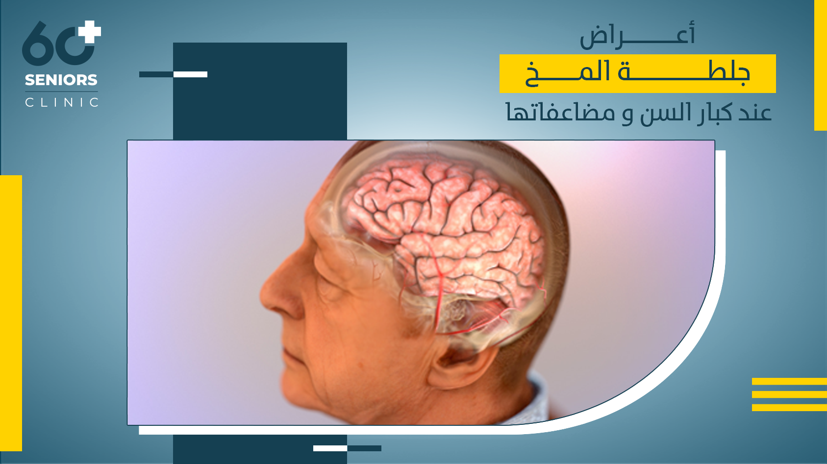 اعراض جلطة المخ عند كبار السن ومضاعفاتها